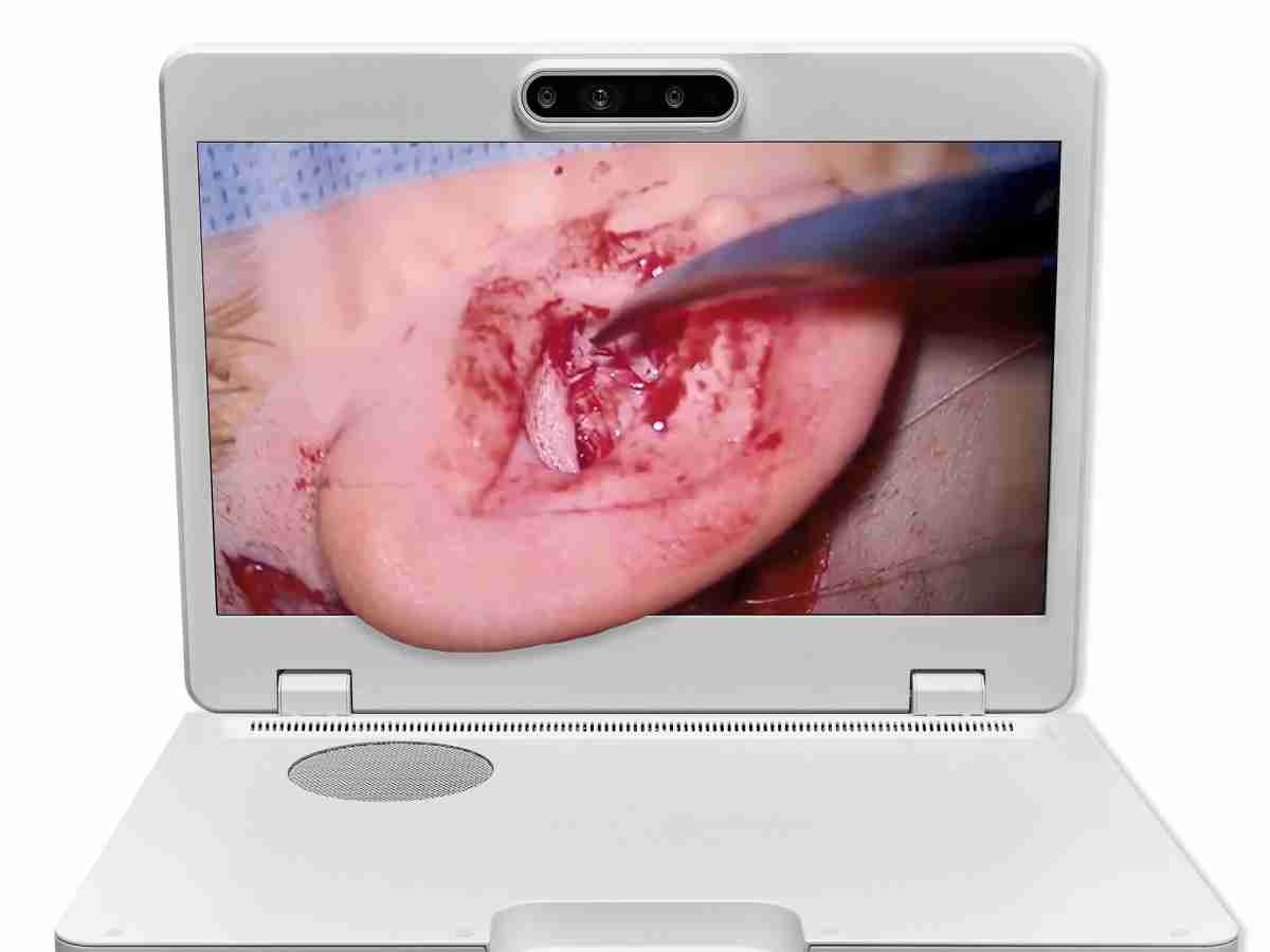 达擎之＂Heads-up 3D显微手术显示系统＂，，整合4K裸眼3D显示及眼球追踪系统，，，，具备快速追踪人眼移动位置功能，，减轻医师长时间维持固定姿势的负担，，，让医师能有更宽广清晰的3D立体视野及更舒适的姿势来执行手术。。